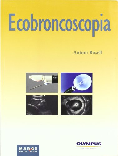 9788492442300: Ecobroncoscopia (SIN COLECCION)