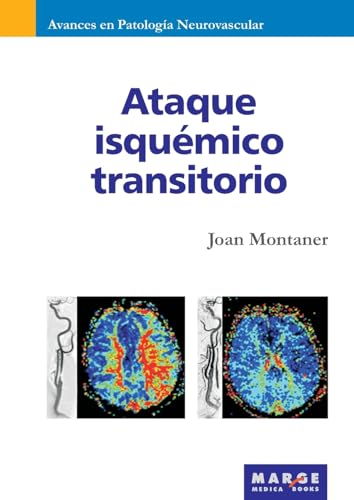9788492442485: Ataque isqumico transitorio: 0 (Avances en Patologa Neurovascular)