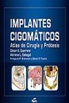 9788493779320: IMPLANTES CIGOMATICOS. ATLAS DE CIRUGIA Y PROTESIS