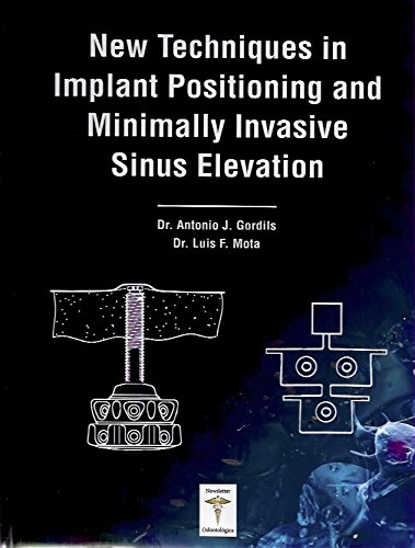 9788494494413: NEW TECHNIQUES IN IMPLANT POSITIONING AND MINIMALLY INVASIVE SINUS ELEVATION