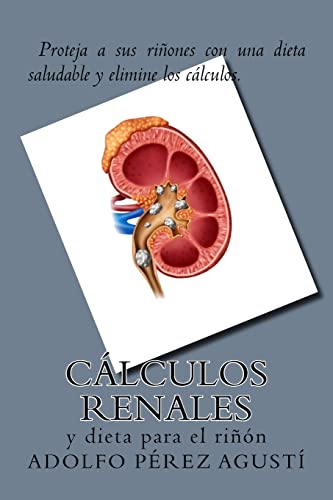 Beispielbild fr Clculos renales: y dieta para el rin (Terapias y nutricin) (Spanish Edition) zum Verkauf von GF Books, Inc.