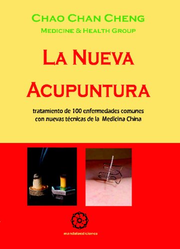 Imagen de archivo de La nueva acupuntura a la venta por Iridium_Books