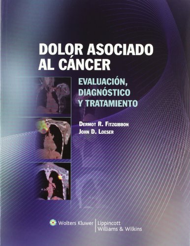 Imagen de archivo de DOLOR ASOCIADO AL CNCER a la venta por Iridium_Books