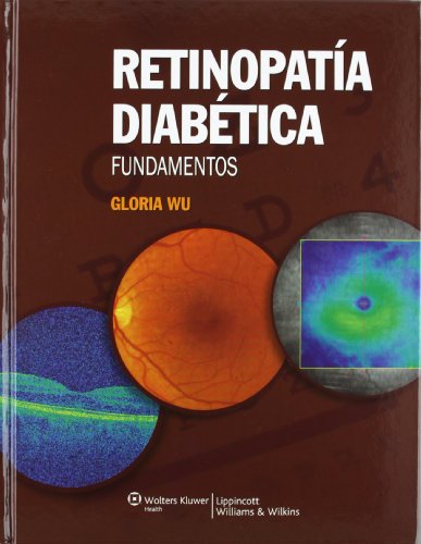 Imagen de archivo de RETINOPATIA DIABETICA a la venta por Iridium_Books