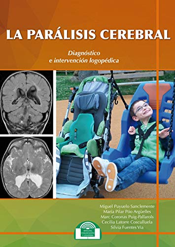 Imagen de archivo de LA PARALISIS CEREBRAL. DIAGNOSTICO E INTERVENCION LOGOPEDICA a la venta por KALAMO LIBROS, S.L.