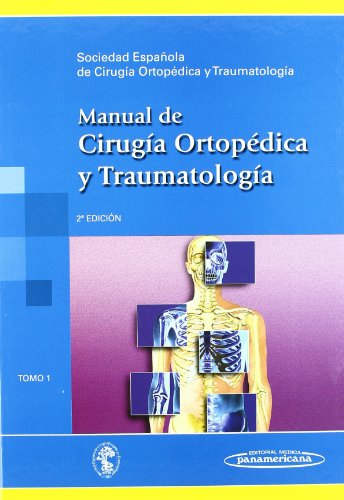 Stock image for Manual de Ciruga Ortopdica y Traumatologa: 1 for sale by OM Books