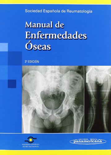 9788498352306: Manual de enfermedades oseas