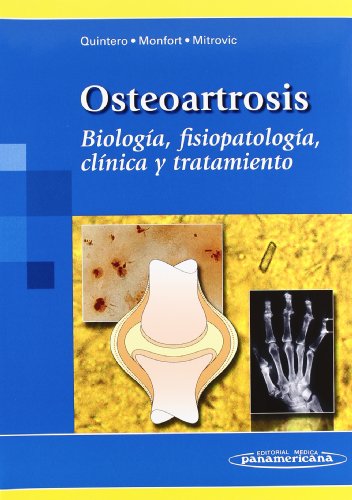 Osteoartrosis / Osteoarthritis: Biologia, fisiopatologia, clinica y tratamiento / Biology, Pathophysiology, Clinical and Treatment (Spanish Edition) - Maritza Quintero