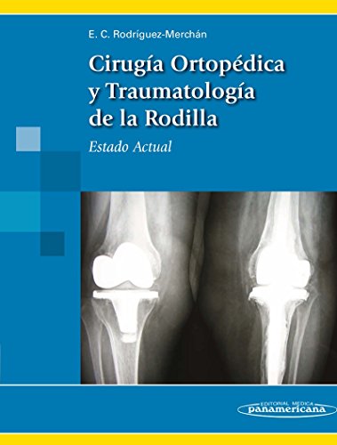 Beispielbild fr Cirugia Ortopedica y Traumatologia de la Rodilla zum Verkauf von Librera 7 Colores