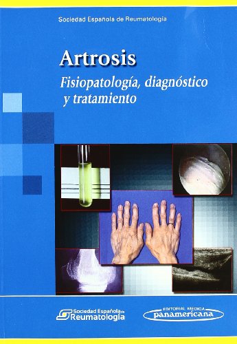 Imagen de archivo de Artrosis / Osteoarthritis: Fisiopatologia, Diagnostico Y Tratamiento / Pathophysiology, Diagnosis and Treatment a la venta por Revaluation Books