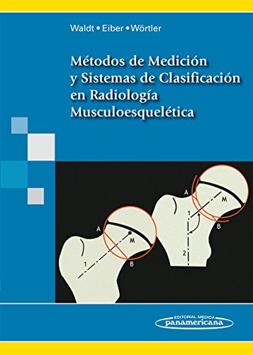 9788498355208: Mtodos de Medicin y Clasificacines en Radiologa Musculoesqueltica