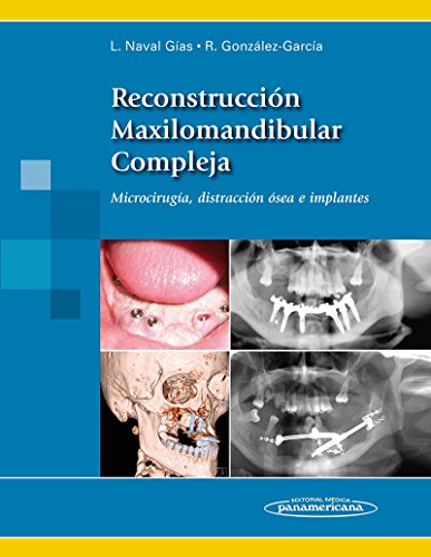 9788498356083: Reconstruccion maxilomandibular compleja