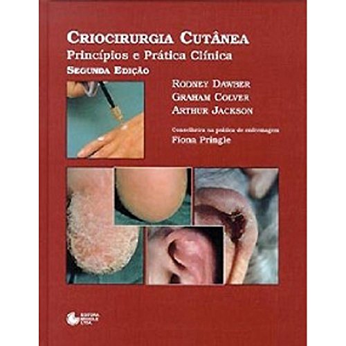 Stock image for Criocirurgia Cutnea: Princpios e Prtica Clnica (2 Edio) for sale by Luckymatrix