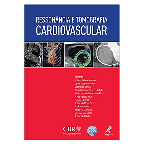 Imagen de archivo de Ressonncia e Tomografia Cardiovascular a la venta por GF Books, Inc.