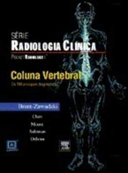 Beispielbild fr livro pocket radiologia coluna vertebral zum Verkauf von LibreriaElcosteo