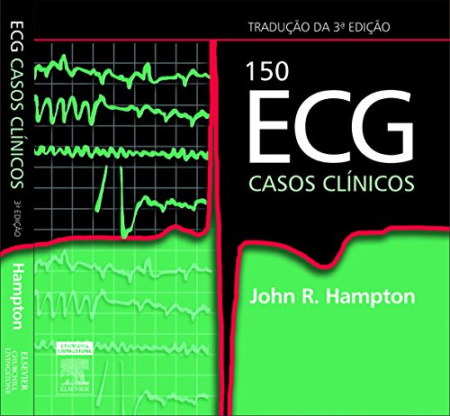 Beispielbild fr 150 ECG Casos Clinicos zum Verkauf von P.C. Schmidt, Bookseller