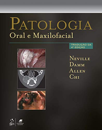 9788535265644: Patologia Oral E Maxilofacial