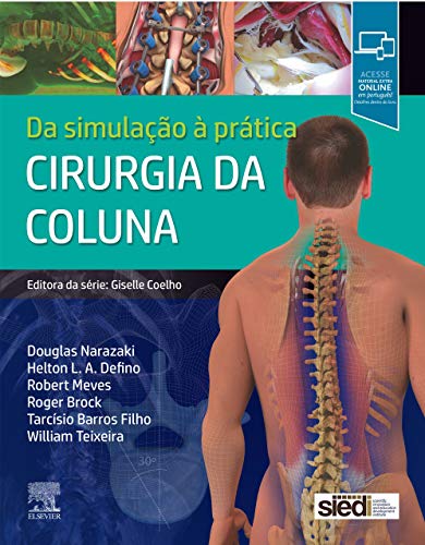 Stock image for cirurgia da coluna for sale by LibreriaElcosteo