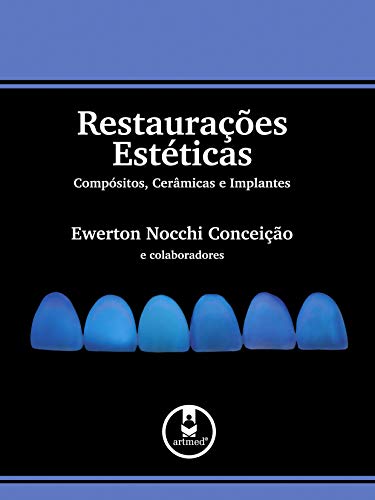 9788536304229: Restauraes Estticas. Compsitos, Cermicas e Implantes (Em Portuguese do Brasil)