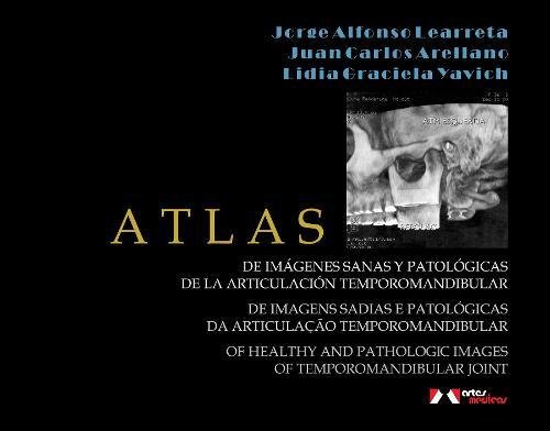9788536700700: Atlas: Of Healthy and Pathologic Images of Temporomandibular Joint
