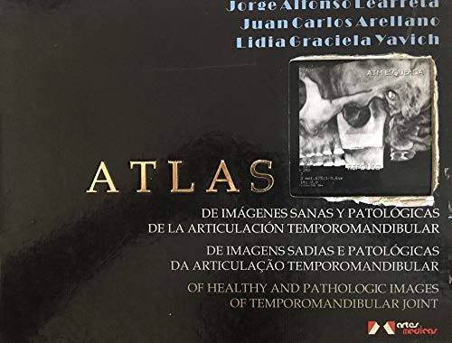 9788536700700: Atlas: Of Healthy and Pathologic Images of Temporomandibular Joint