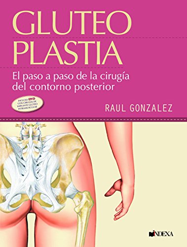 9788560138043: Gluteoplastia: EL PASO A PASO DE LA CIRUGA DEL CONTORNO POSTERIOR