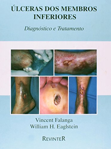 Stock image for ulceras dos membros inferiores diagnostico e tratamento for sale by LibreriaElcosteo