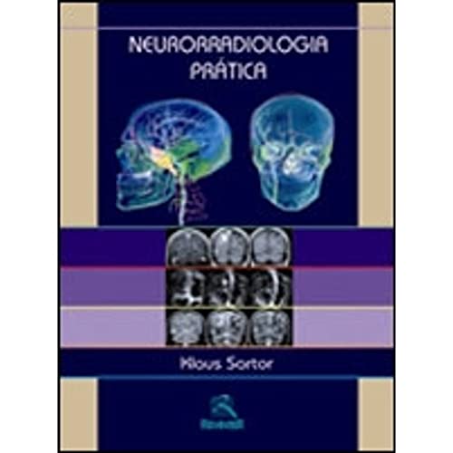 9788573095272: Neurorradiologia Prtica