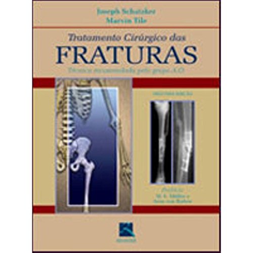 Stock image for livro tratamento cirurgico das fraturas schatzker for sale by LibreriaElcosteo