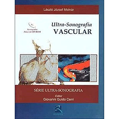 Stock image for Ultra-Sonografia Vascular + Atlas em Cd-Rom for sale by Luckymatrix