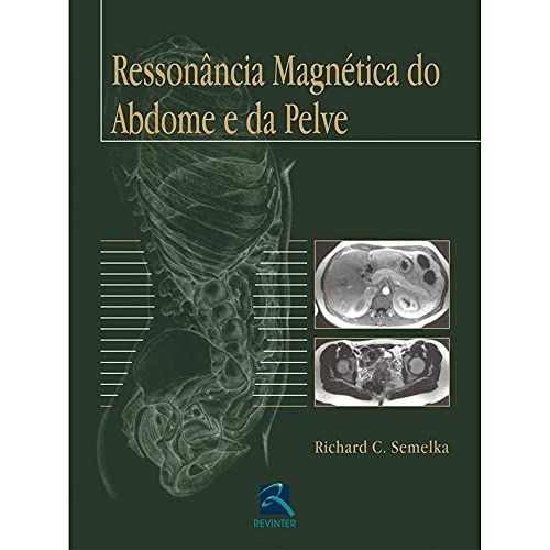 Stock image for livro ressonncia magnetica do abdome e da pelve richard c semelka 2005 for sale by LibreriaElcosteo