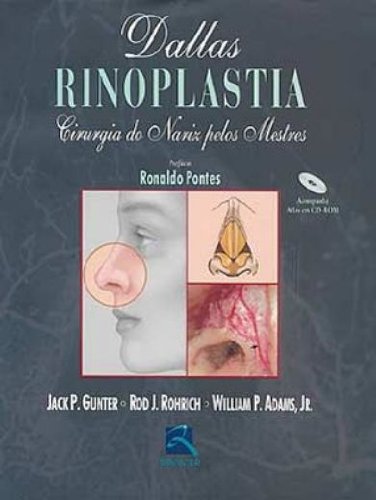Imagen de archivo de Rinoplastia. Cirurgia Do Nariz Pelos Mestres a la venta por ThriftBooks-Atlanta
