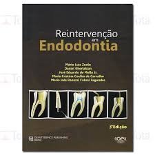 Stock image for livro reintervenco em endodontia 3 edico zuolo for sale by LibreriaElcosteo