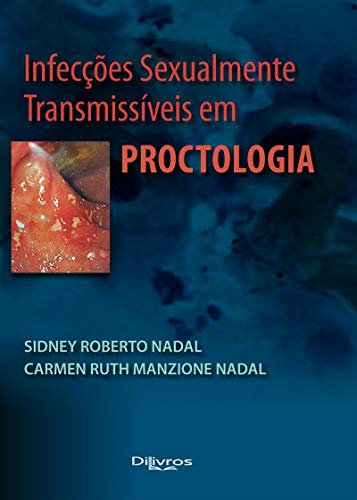 Imagen de archivo de livro infeccoes sexualmente transmissiveis em proctologia a la venta por LibreriaElcosteo