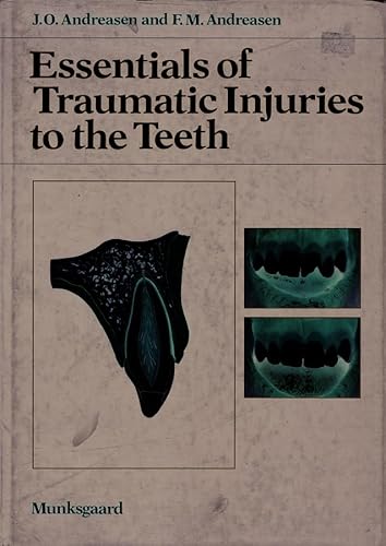 Stock image for Essentials of Traumatic Injuries to the Teeth for sale by Anybook.com