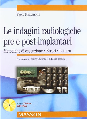 9788821427879: Le indagini radiologiche pre e post-implantari. Metodiche di esecuzione. Errori. Lettura