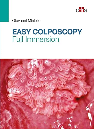 9788821449826: Easy Colposcopy. Full Immersion