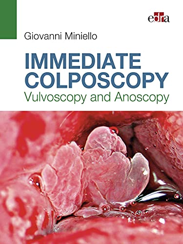 9788821455124: Immediate Colposcopy - Vulvoscopy and Anoscopy