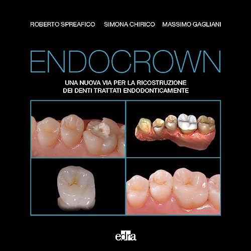 Imagen de archivo de Endocrown. Una nuova via per la ricostruzione dei denti trattati endodonticamente a la venta por libreriauniversitaria.it