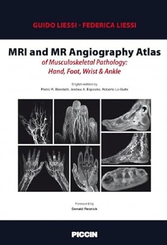 Stock image for Mri And Mr Angiography Atlas Of Musculoskeletal Pathology Hand Foot Wrist And Ankle (Hb 2017) for sale by Basi6 International