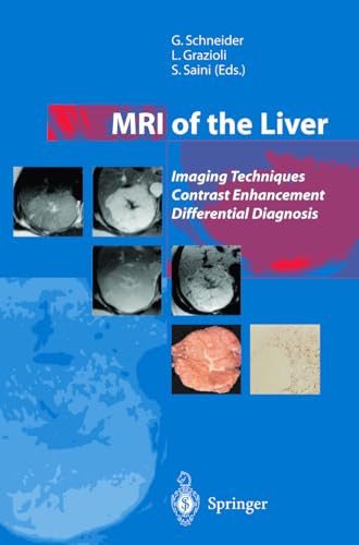 Imagen de archivo de MRI of the Liver: Imaging Techniques Contrast Enhancement Differential Diagnosis a la venta por Patrico Books