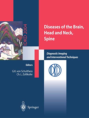 Diseases of the Brain, Head and Neck, Spine. Diagnostic Imaging and Interventional Techniques.