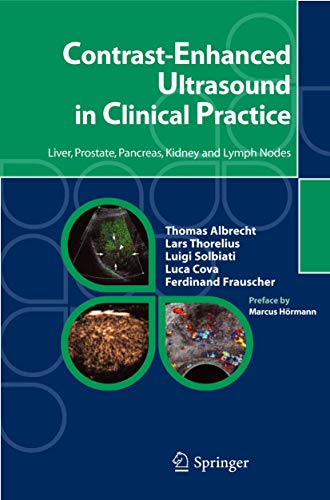 9788847003040: Contrast-Enhanced Ultrasound in Clinical Practice: Liver, Prostate, Pancreas, Kidney and Lymph Nodes