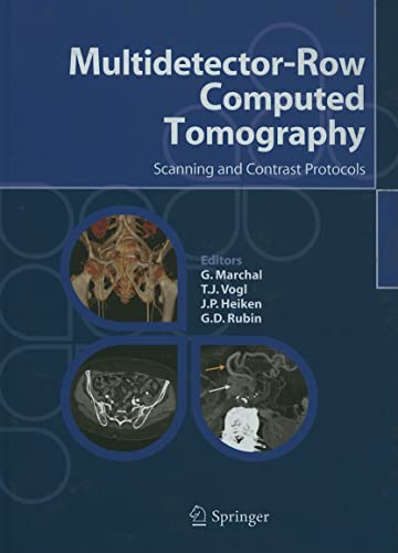 Stock image for Multidetector-Row Computed Tomography: Scanning and Contrast Protocols for sale by HPB-Red