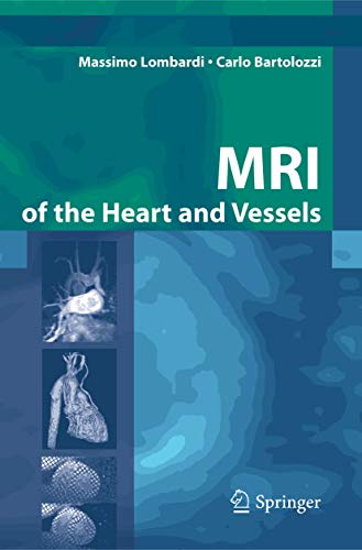 Stock image for Mri Of The Heart And Vessels for sale by Romtrade Corp.