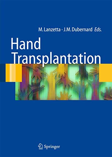 Imagen de archivo de Hand Transplantation a la venta por Better World Books