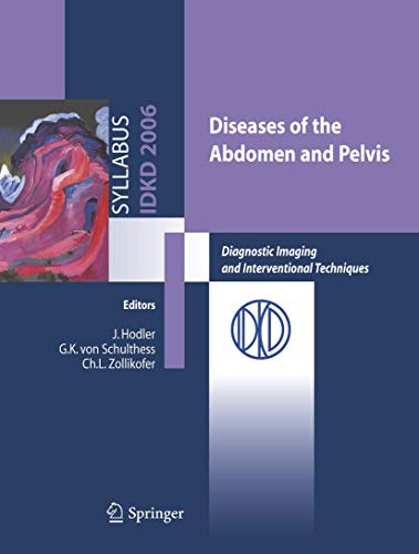 Imagen de archivo de Diseases Of The Abdomen And Pelvis a la venta por Basi6 International