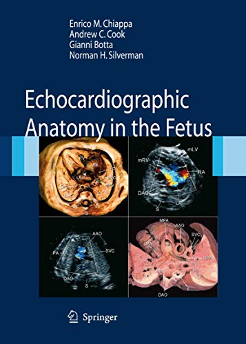 9788847005723: Echocardiographic. Anatomy in the fetus. Con DVD