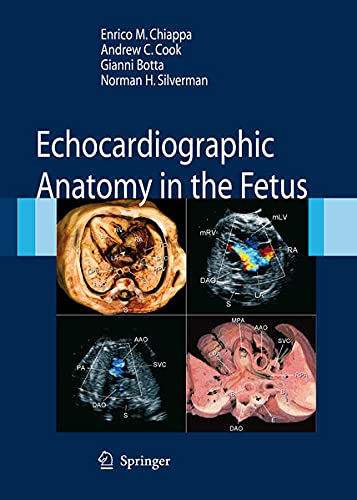 9788847005730: Echocardiographic Anatomy in the Fetus