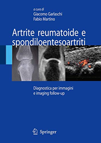9788847006850: Artrite reumatoide e spondiloentesoartriti: Diagnostica per immagini ed imaging follow-up